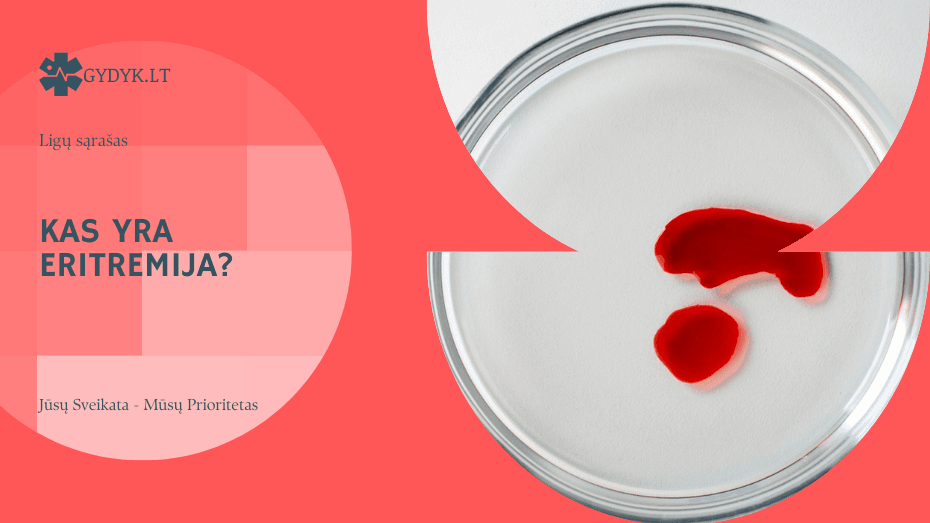 Kas yra eritremija? Priežastys, simptomai ir gydymas