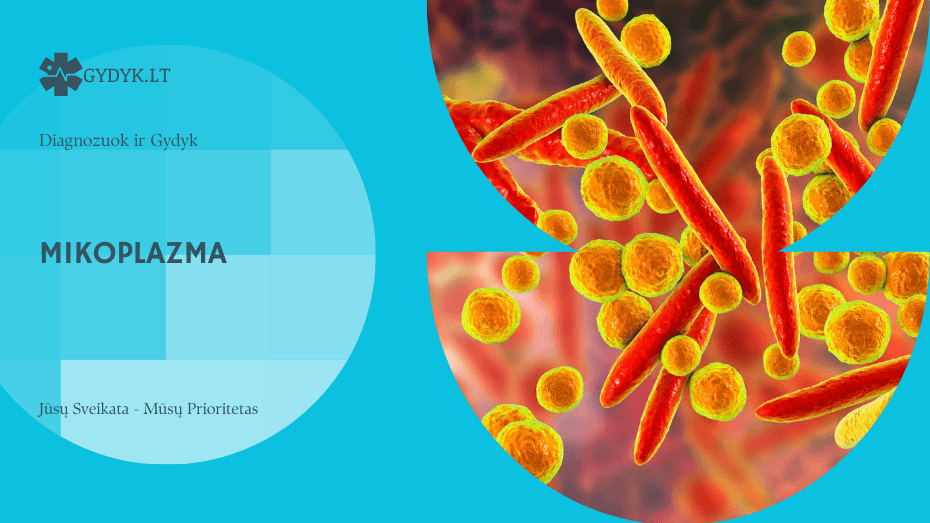 Mikoplazma: simptomai, tyrimai, gydymas antibiotikais ir ar ji užkrečiama